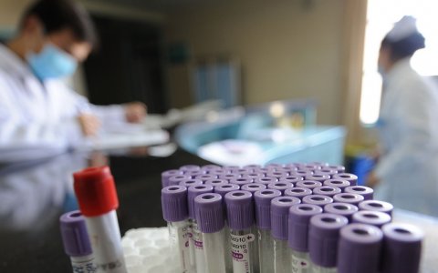 За неделю в области 207 случаев заболевания ветрянкой, в Гусеве ребёнок заболел скарлатиной