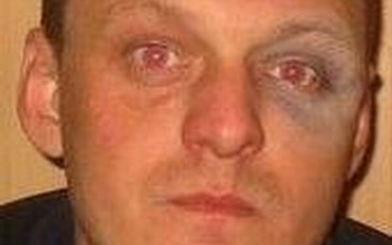 Полиция Гусева разыскивает за дезертирство Сергея Семенко